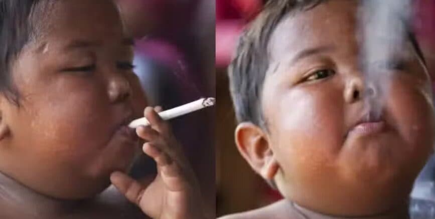 Lembra dele? Veja como ficou menino conhecido por fumar 40 cigarros por dia aos 2 anos