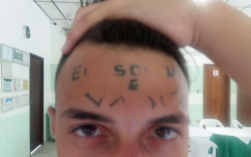 Resultado de imagem para Jovem que teve "ladrÃ£o e vacilÃ£o" tatuado na testa Ã© preso por suspeita de furto