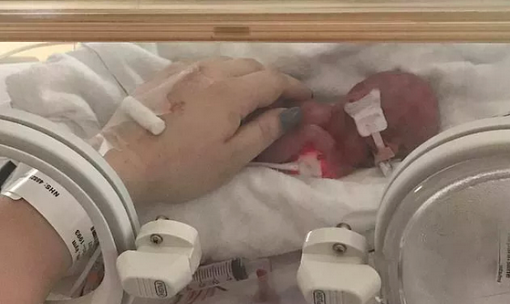 Bebe Nasce Com 24 Semanas De Gestacao E Recebe Alta Apos 6 Meses 98fm Curitiba Sintonize 98 9 Bebe Nasce Com 24 Semanas De Gestacao E Recebe Alta Apos 6 Meses 98fm Curitiba Sintonize 98 9